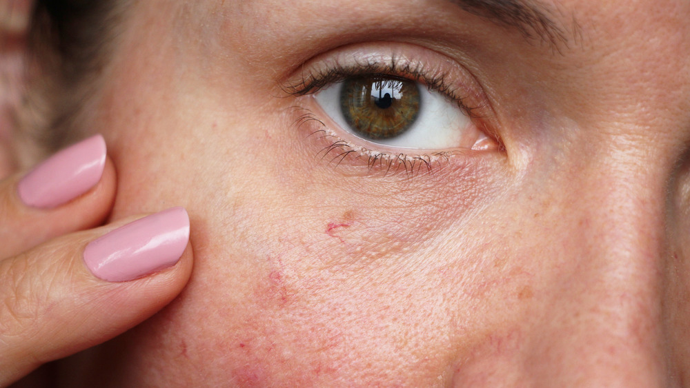 Woman touching skin near her eye